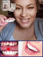 Full Denture Set