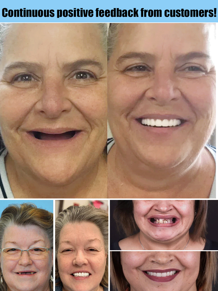 Full Denture Set